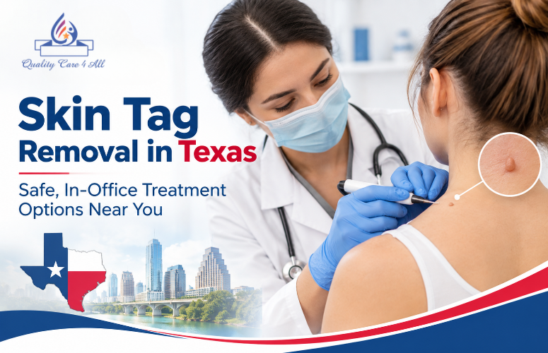 Skin Tag Removal in Texas during professional in-office evaluation